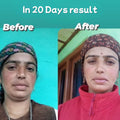 Skin Magic Day Cream customer transformation before and after 20 days
