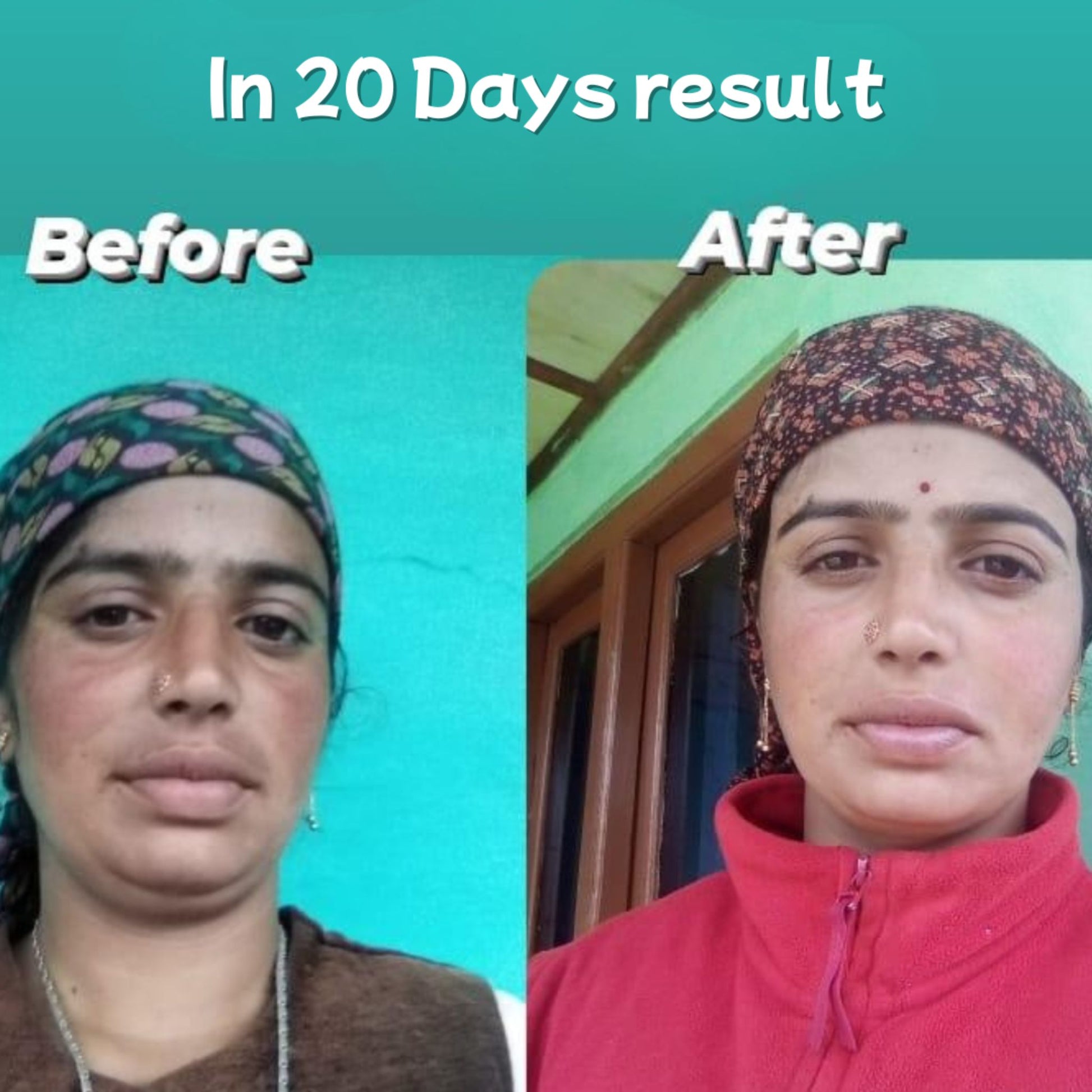 Skin Magic Day Cream customer transformation before and after 20 days
